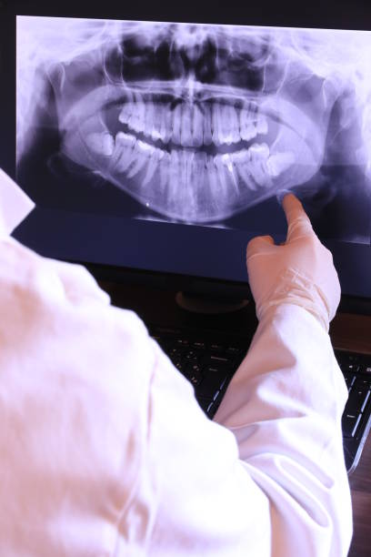 Best Emergency Tooth Extraction in Tracy, MN