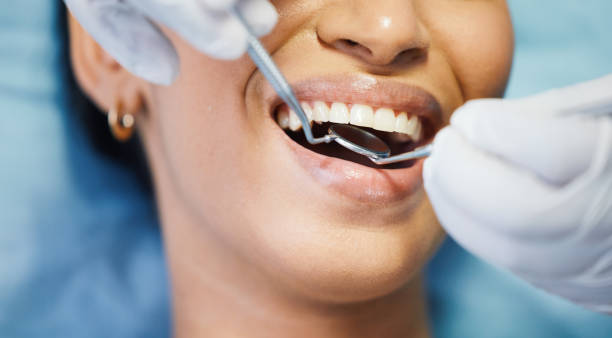 Best Emergency Dental Care for Broken or Chipped Teeth in Tracy, MN